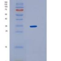 人3-羟甲基-3-甲基戊二酰辅酶A裂合酶(HMGCL)重组蛋白