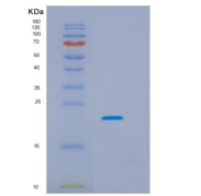 人HSPC159重组蛋白