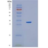 人血红素氧合酶1(HO1)重组蛋白