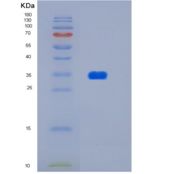 人HtrA2/Omi 134-458重组蛋白