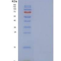 人热休克因子结合蛋白1样蛋白1 (HSBP1L1)重组蛋白