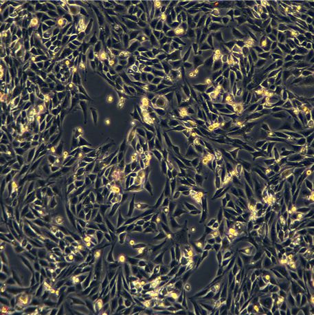 L6细胞 大鼠成肌细胞