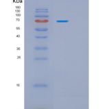 人70kDa热休克蛋白9(HSPA9)重组蛋白