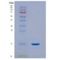 人结合珠蛋白(Hpt)重组蛋白