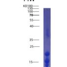 人白介素15(IL15)重组蛋白