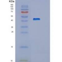 人HEXIM1重组蛋白