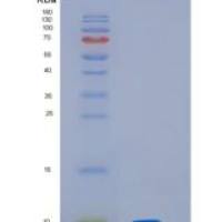 人10kDa热休克蛋白1(HSP10)重组蛋白