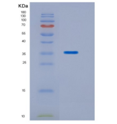 人同源盒蛋白Hox-C11重组蛋白