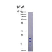 小鼠白介素15(IL15)重组蛋白