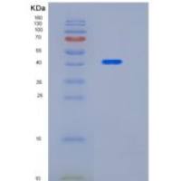 人羟赖氨酸激酶(HYKK)重组蛋白