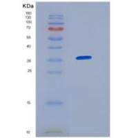 人不均一核糖核蛋白A1(HNRNPA1)重组蛋白