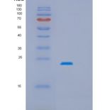 人热休克蛋白β2(HSPb2)重组蛋白