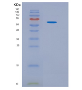 人肝素酶(HPSE)重组蛋白
