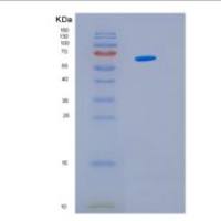 人60kD热休克蛋白(Hsp60)重组蛋白