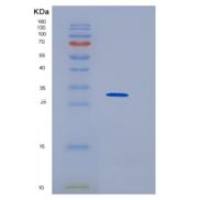 人HNRNPK重组蛋白