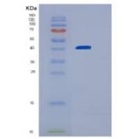 人Homer 1重组蛋白