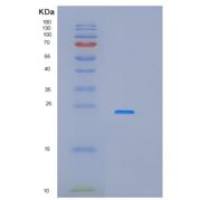 人干扰素α14(IFNa14)重组蛋白