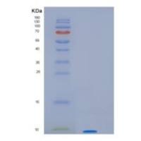 人热休克因子结合蛋白1(HSBP1)重组蛋白