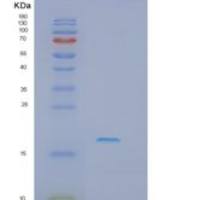 人IFT20重组蛋白