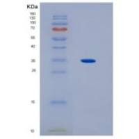人HLA-C重组蛋白