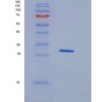 人HDGFL1重组蛋白