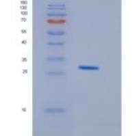 人HDGFL1重组蛋白