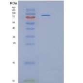 人90kDa热休克蛋白β1(HSP90b1)重组蛋白