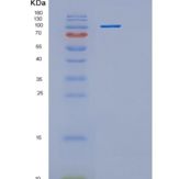 人己糖激酶2(HK2)重组蛋白