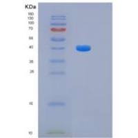 人3-羟异丁酰辅酶A水解酶(HIBCH)重组蛋白