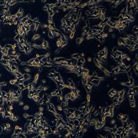 B16小鼠黑色素瘤细胞