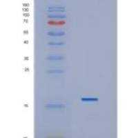 人白介素1β(IL1b)重组蛋白