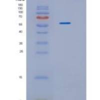 人艾杜糖-2-硫酸酯酶(IDS)重组蛋白