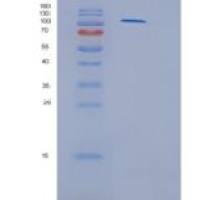 人己糖激酶3(HK3)重组蛋白