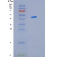 人异柠檬酸脱氢酶1(IDH1)重组蛋白