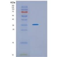 人硫酸乙酰肝素氨基葡萄糖3-O-磺基转移酶1（hs3st 1）重组蛋白