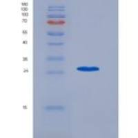 人白介素6(IL6)重组蛋白