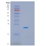 人HSPC159重组蛋白