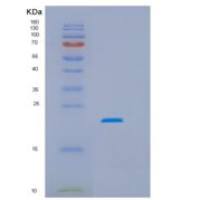 人HSPC159重组蛋白