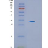 人17-β-羟基类固醇脱氢酶11(HSD17b11)重组蛋白