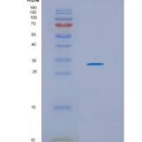 人17-β-羟基类固醇脱氢酶11(HSD17b11)重组蛋白
