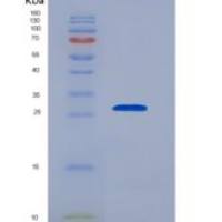 人白细胞介素29(IL29)重组蛋白