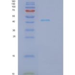 小鼠Ifnar1重组蛋白产品图