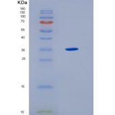 人HLA-F重组蛋白