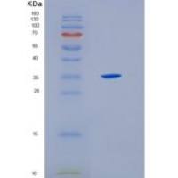 人HLA-F重组蛋白