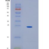 人HLA-DOA重组蛋白