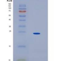 人HLA-DOA重组蛋白