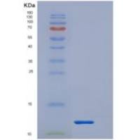 人白介素1受体Ⅰ(IL1R1)重组蛋白