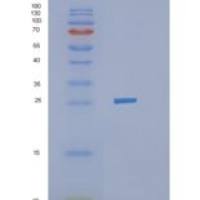 人胰岛素样生长因子结合蛋白6(IGFBP6)重组蛋白