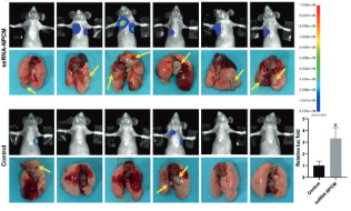 【文献速递】转录因子JUN介导的seRNA形成R环促进鼻咽癌转移