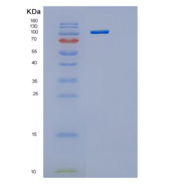 人己糖激酶1（Hexokinase 1）重组蛋白